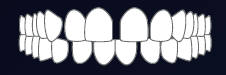 Gap Teeth